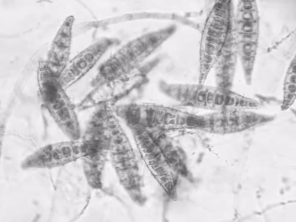 Zarodniki grzyba microsporum canis