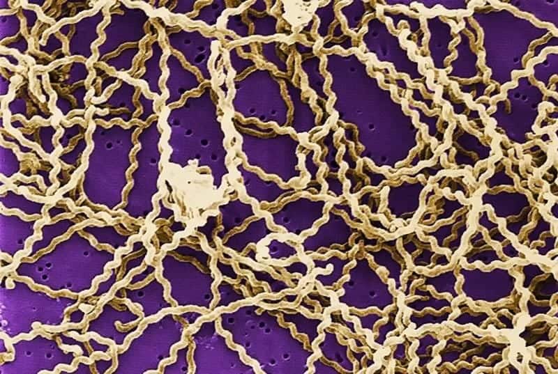 Leptospiroza, obraz mikroskopowy | Źródło: Wikipedia