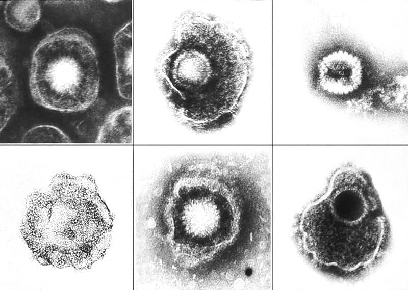 Wirusy z rodziny Herpesviridae