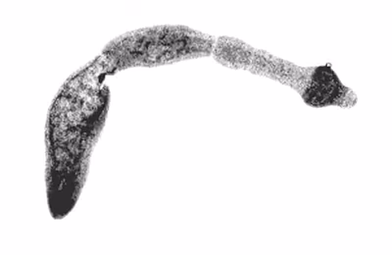Echinococcus multilocularis