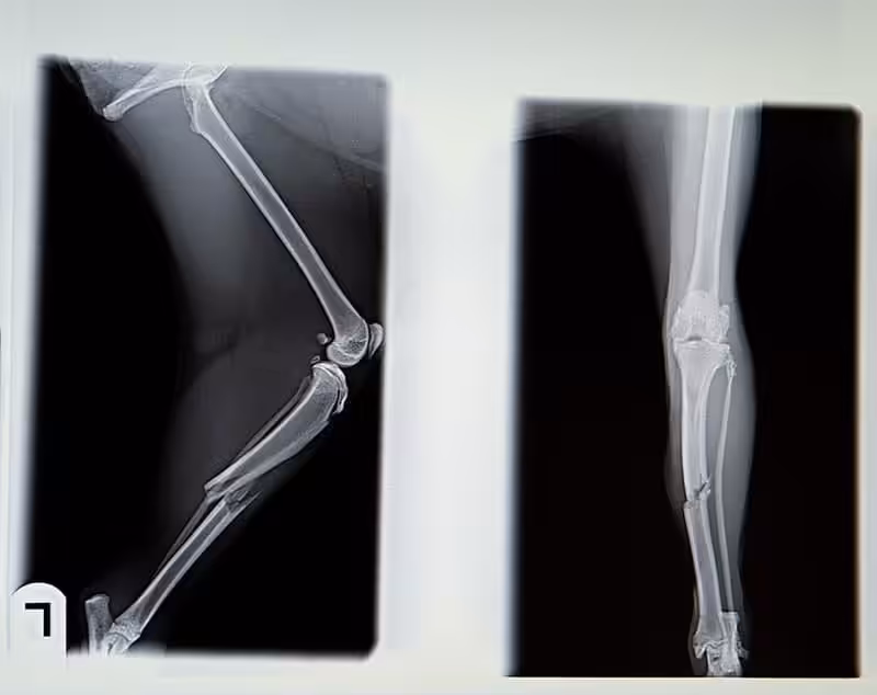 Badanie radiologiczne kości