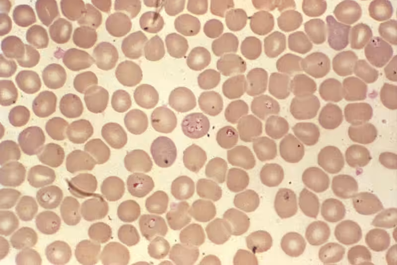 Pierwotniaki Babesia spp